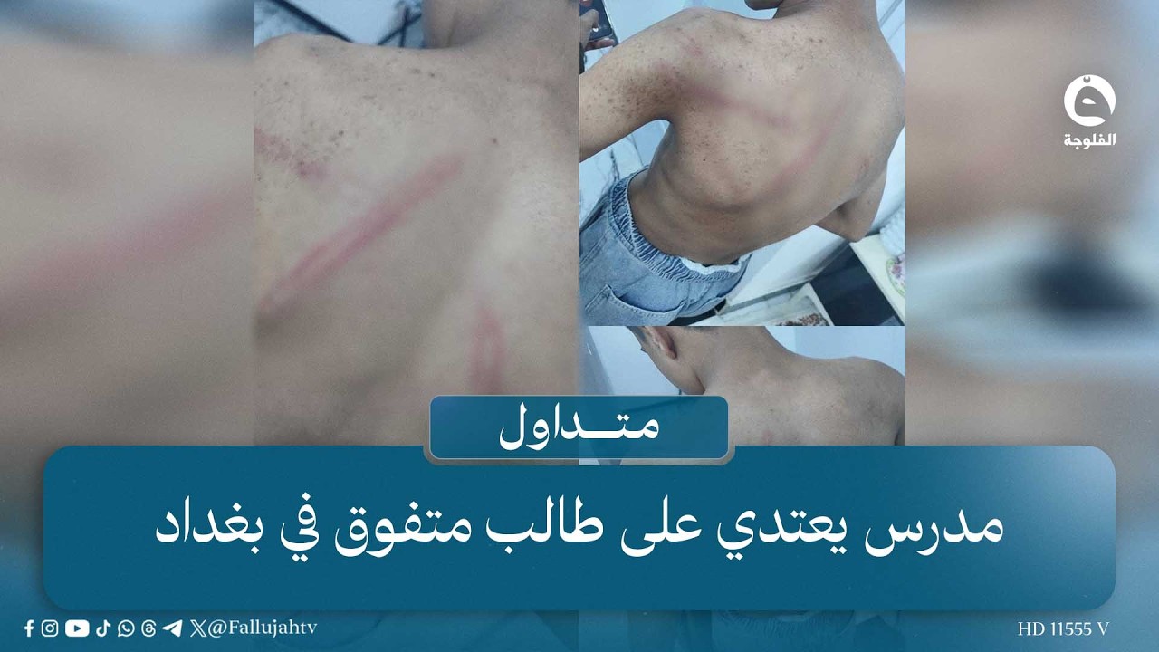 خرب عليه فرحة الإعفاء!! مدرس يعـ..ـتـ..ـدي على طالب متفوق بـ"البوري"   #متداول #قناة_الفلوجة