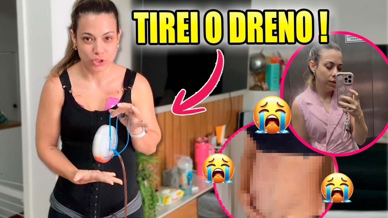 Tomei BANHO DEPOIS de 7 DIAS 🤢 - Enfim TIREI ISSO DE MIM APÓS A CIRURGIA! | Kathy Castricini