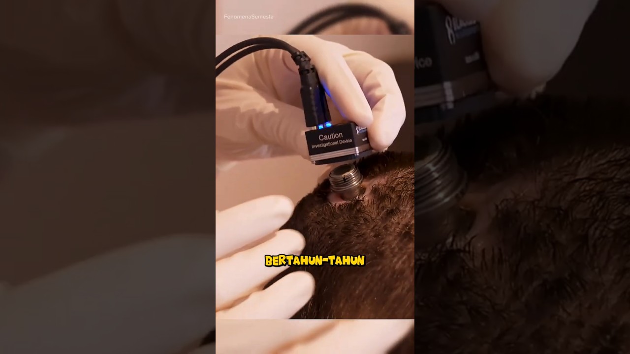 Teknologi AI Mengembalikan Suara yang Hilang