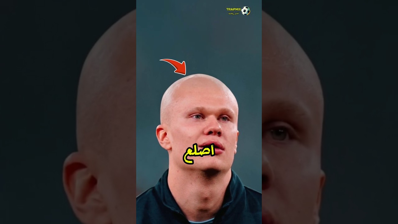 هل Erling Haaland أصلع فعلاً؟ 😳