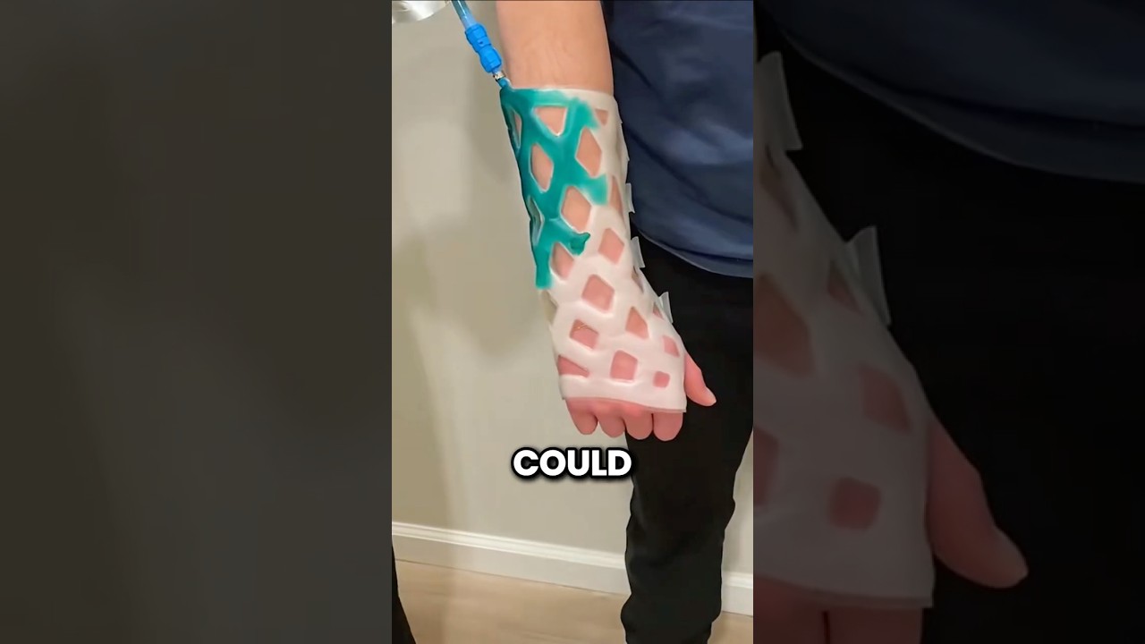 This Could Replace Every Cast You've Ever Hated - Published by TheDailyCurio