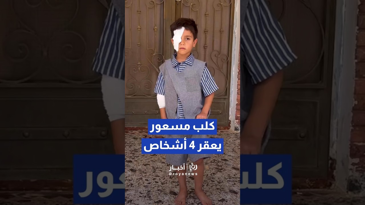 إصابة 4 أشخاص إثر هجوم لكلب مسعور في بلدة ماعين بمحافظة مادبا #shorts #short #shortsclip