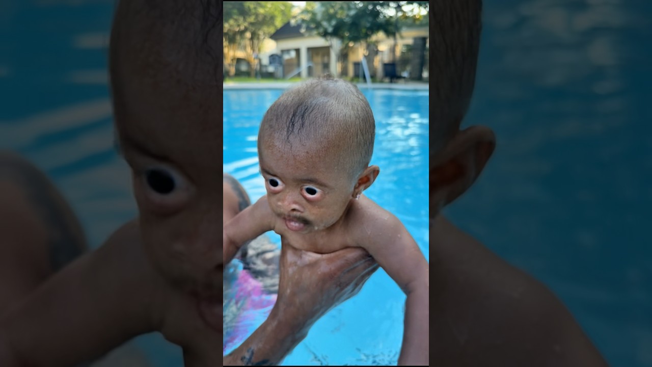Baby Say Say Has The Ugly Curse #fge #family #shorts #scary #kids #fgefamily #uglyfamily #kidsfun