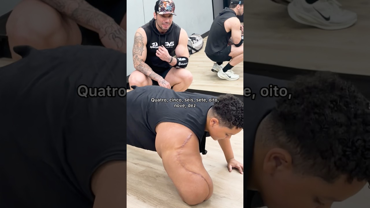 ELE JÁ FEZ MAIS DE 10 CIRURGIAS‼️😰🥺#viral #meme #trend #dicas #academia