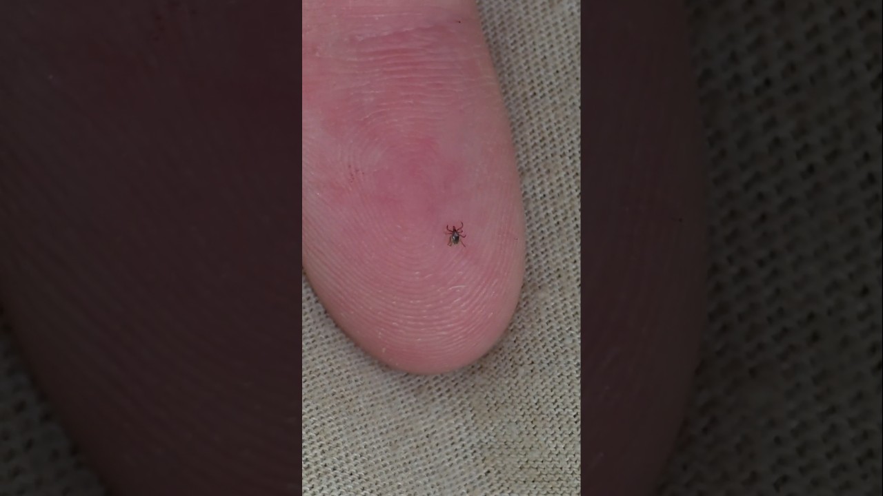 How I deal with ticks
