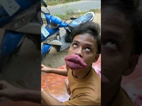 GARA GARA SUNTIKAN COKLAT UNTUK SEMUT #shorts #lucu #art #trending