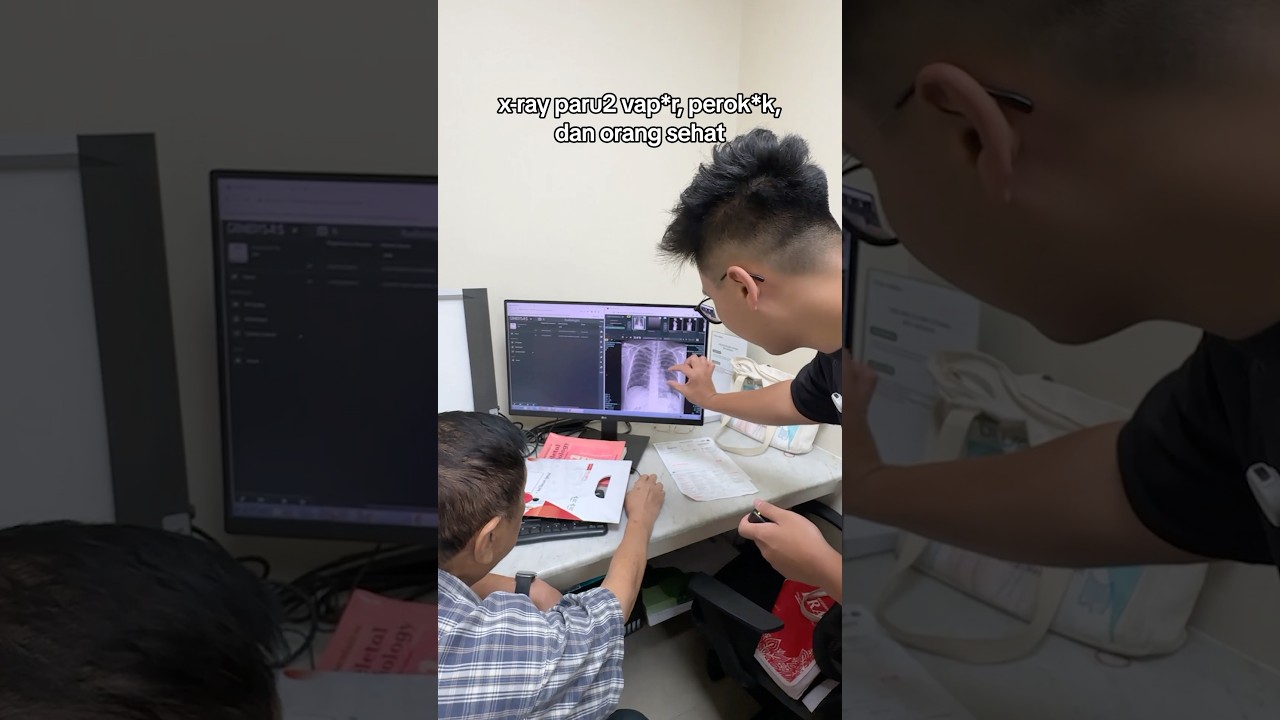 Cek paru2 pake XRAY!