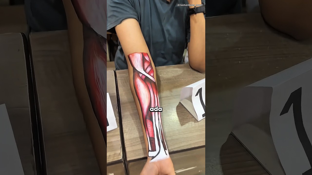 Siswa Ini Benar-benar Membuat Semua Orang Terkejut! 😧