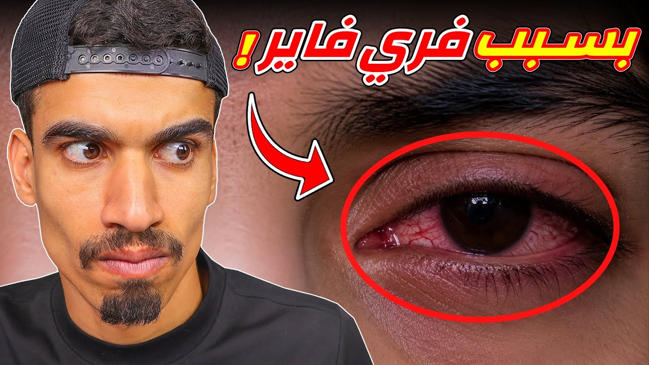 فري فاير لعبة خطيرة !!