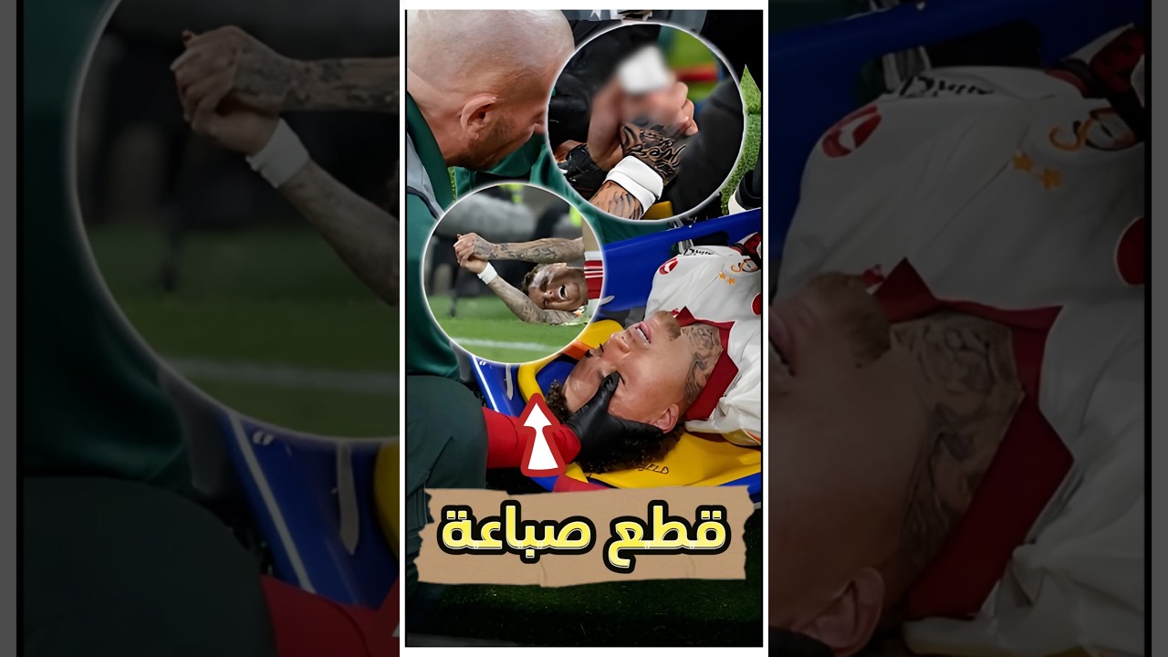 “لقطة مرعبة: إصابة انتهت بقطع صباع لاعب قدام العالم! 💔😨”