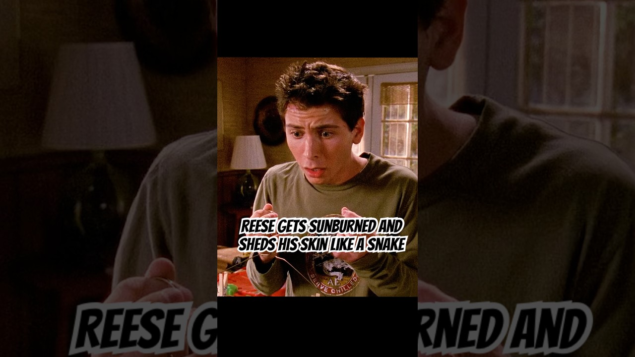 Reese gets sunburned and sheds his skin like a snake.#foryou #malcolminthemiddle #shortvideo #shorts