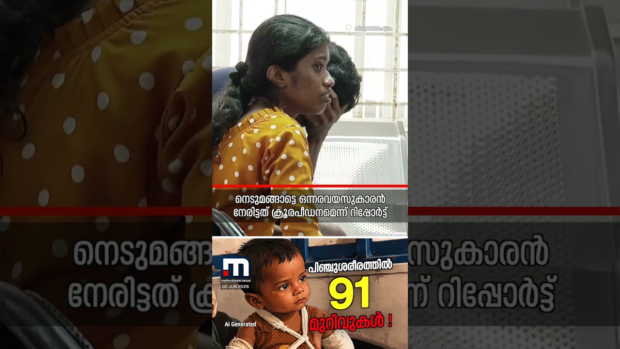 ആ പിഞ്ചുശരീരത്തില്‍ 91 മുറിവുകൾ, നട്ടെല്ലിൽ 7 പൊട്ടൽ; ഒന്നരവയസുകാരൻ നേരിട്ടത് ക്രൂരപീഡനം