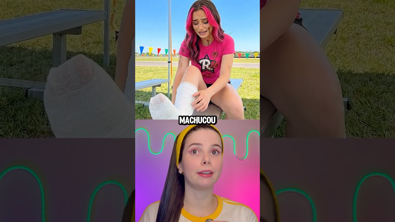 A EMILLY VICK MACHUCOU A PERNA!