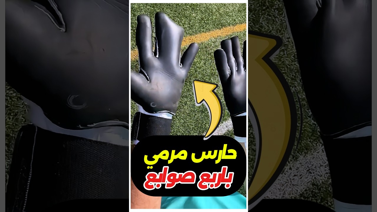 حارس كسر صباعه… ولعب بجوانتي 4 صوابع بس! 😳