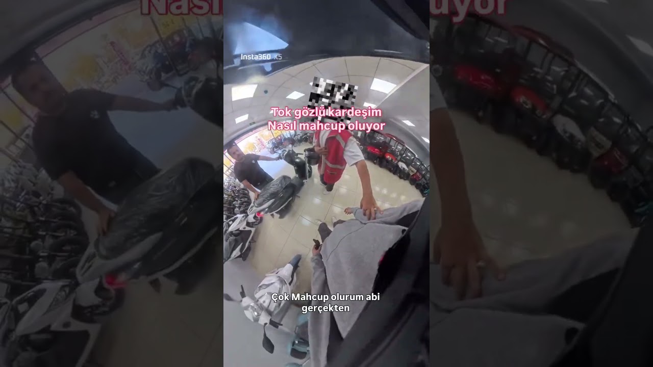 18 yaşında motoru blok yiyince dünyası karardı, biz geleceğini aydınlattık