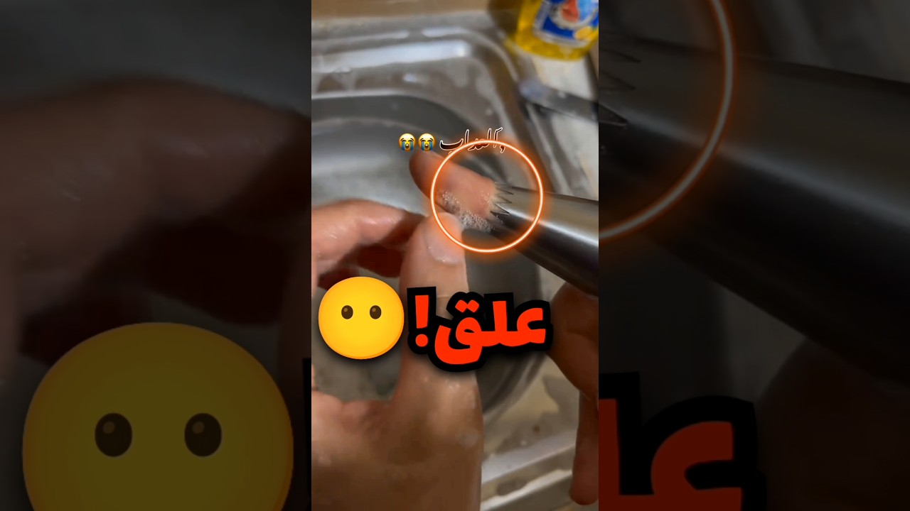 علقت يدها وهي تغسل الاواني وهذا اللي صار💔