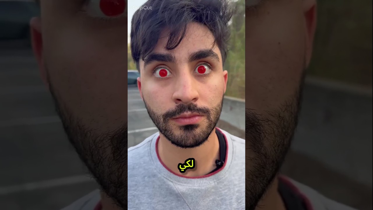 🕷️ لدغة العنكبوت حوّلته إلى سبايدر مان! 😱🕸️