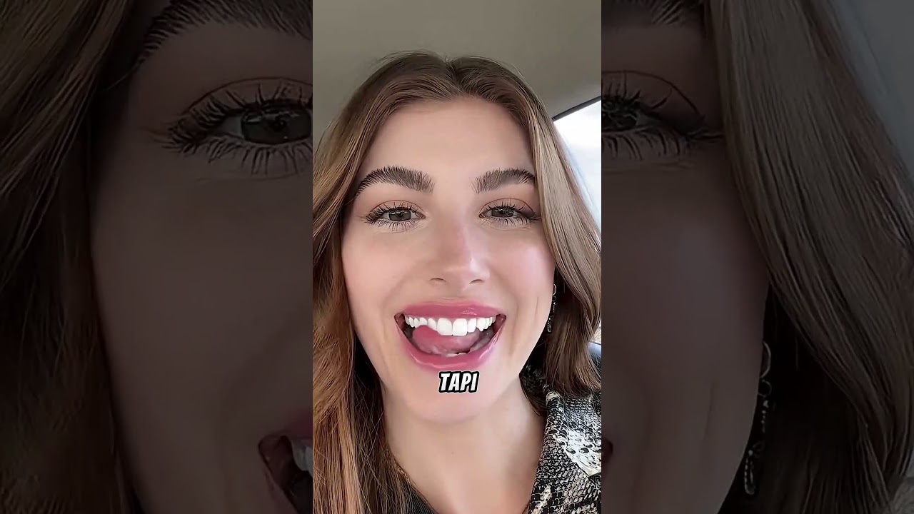 Selalu Dibully Karena Giginya, Kini Senyumnya Bikin Semua Takjub! 😭🦷✨ #shortsviral