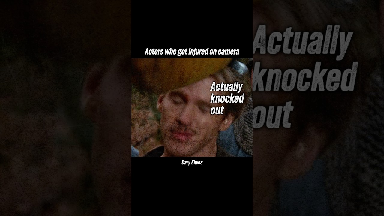 Actors who got injured on camera