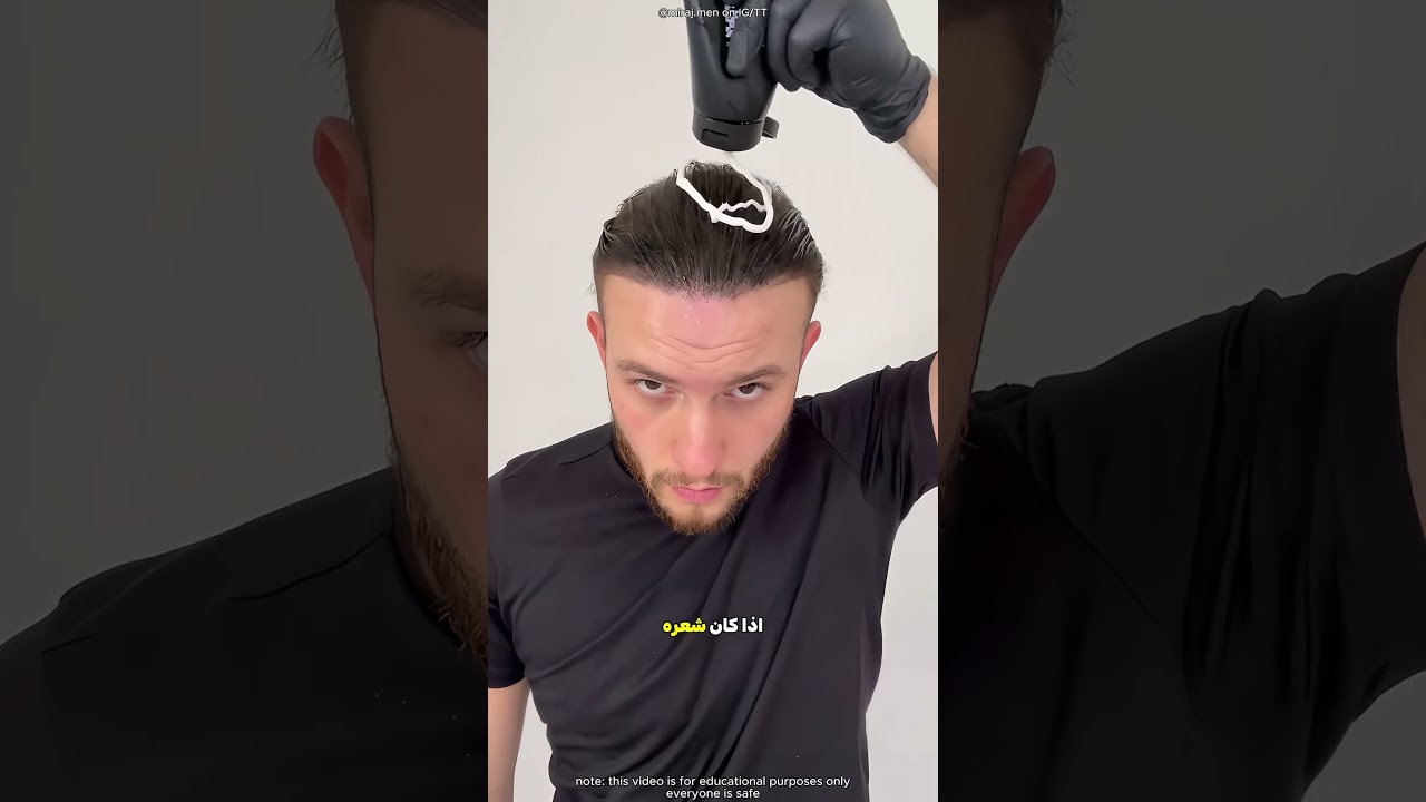 كل الناس افتكروا ان شعره رجع يطول تاني 😮