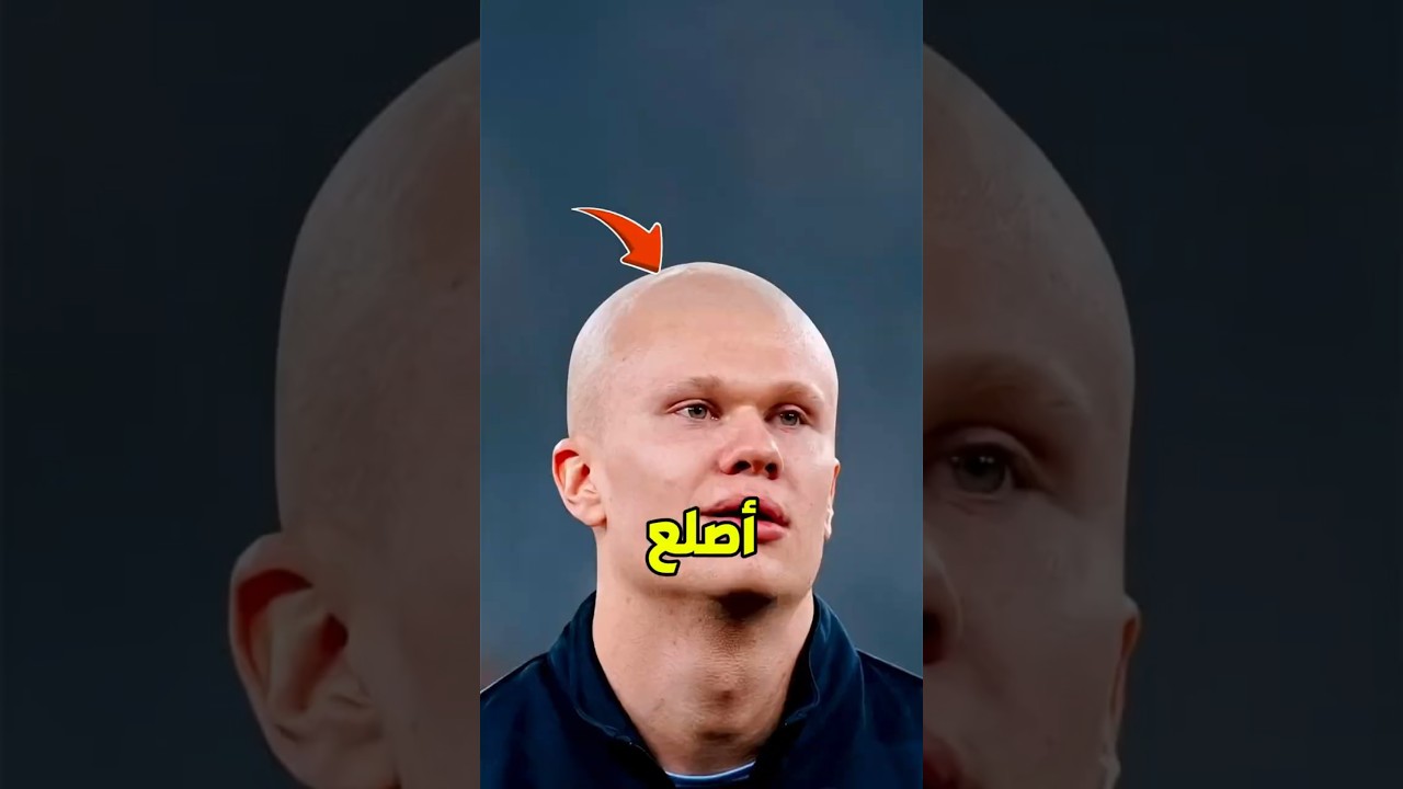 هل هالاند أصلع فعلاً؟ 😳