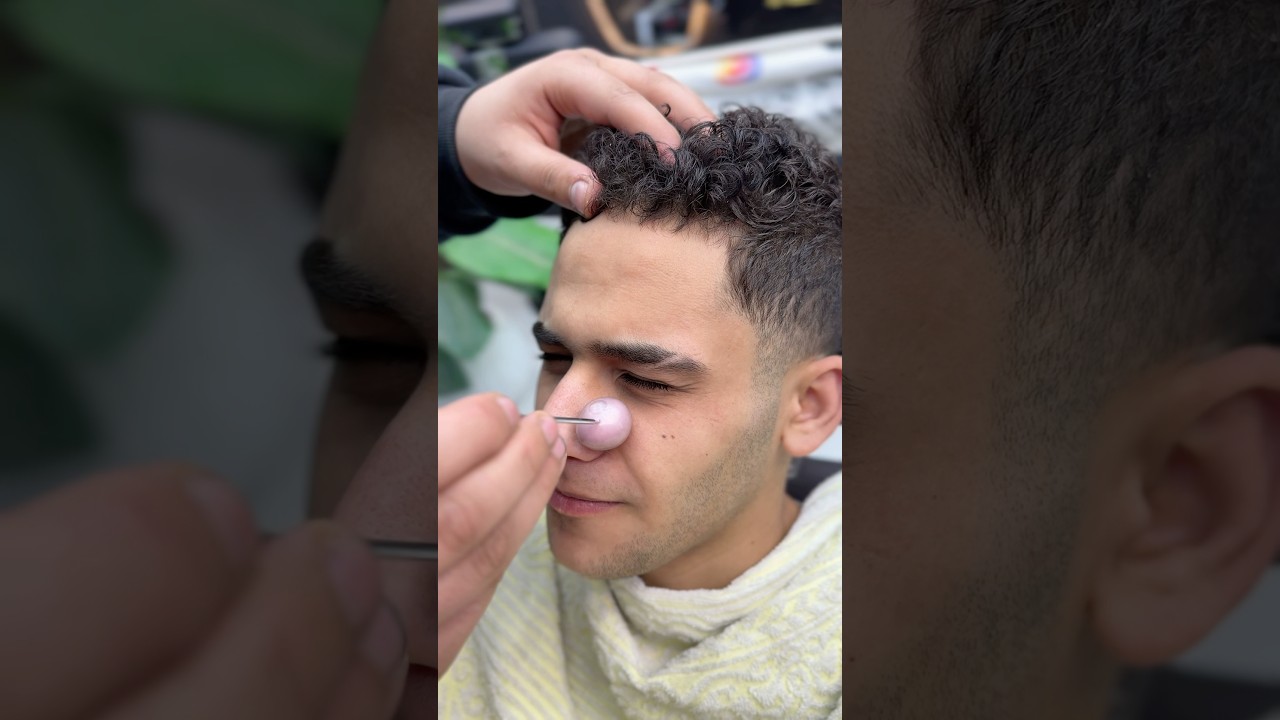 ازالة الحبايه المتسلطنة من الوجه✂️🥵 #fyp #foryou #foryoupage #viral #explore #comedy #asmr