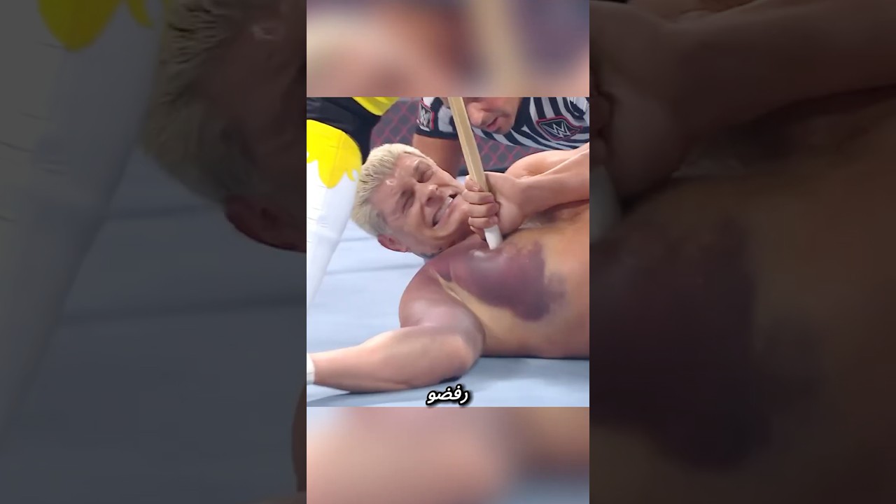 3 إصابات حقيقية في عالم المصارعة صدمت الكل