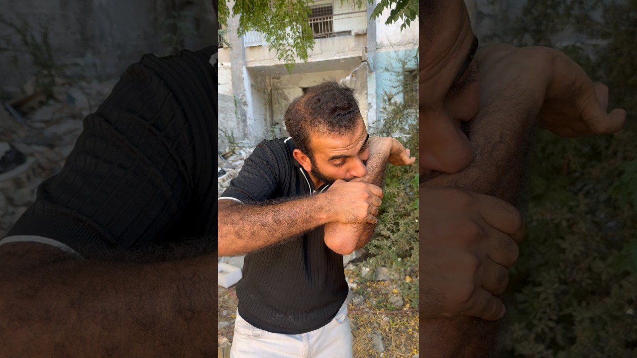 صرت دكتور 🤣🤣عبدالله محمد #shorts