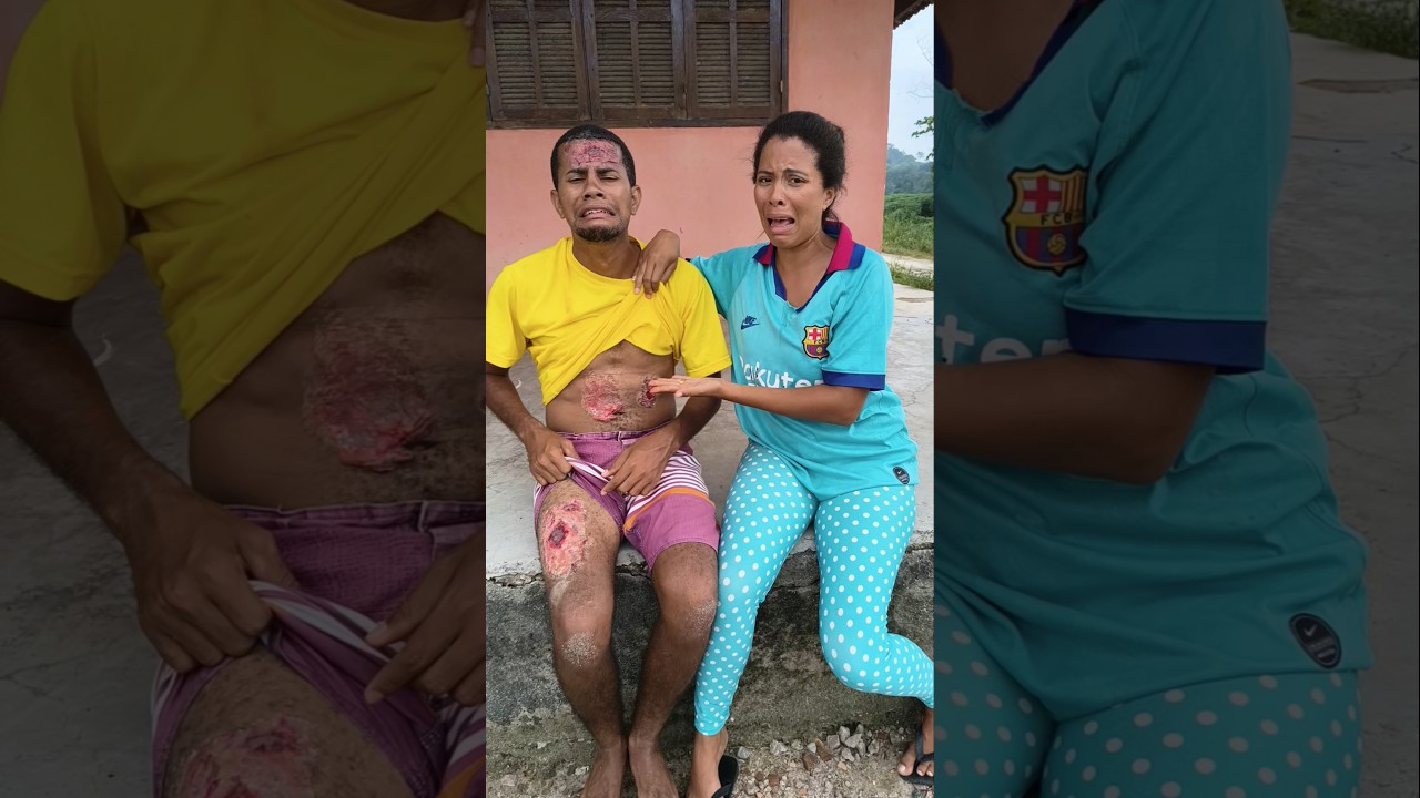 ELA ATACOU MEU IRMÃO MACHUCADO! 😡 #shortsfeed