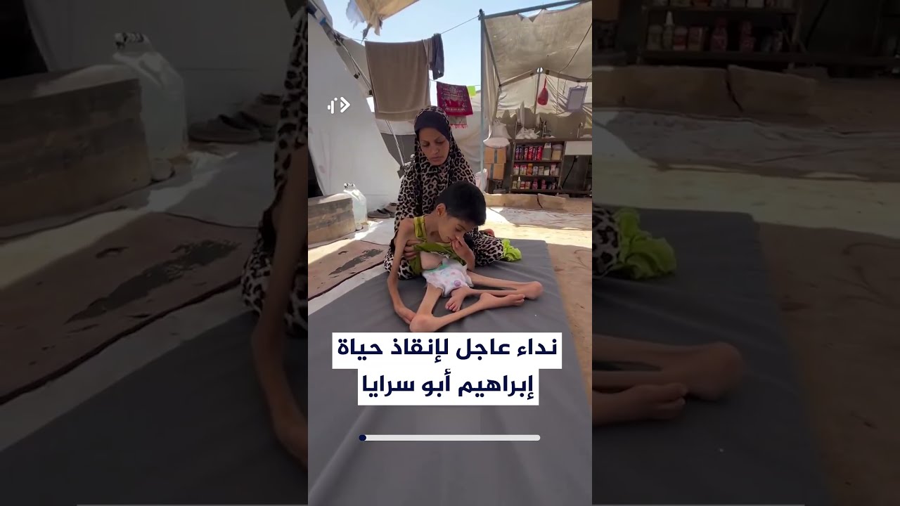نداء عاجل لإنقاذ إبراهيم أبو سرايا.. فتى فلسطيني 16 عامًا يناشد للسفر وتلقي العلاج خارج غزة