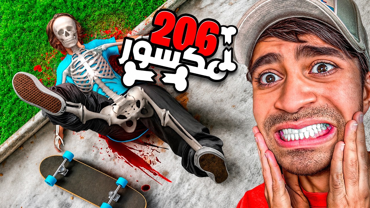 لعبة تكسير العظام المجنونة !!