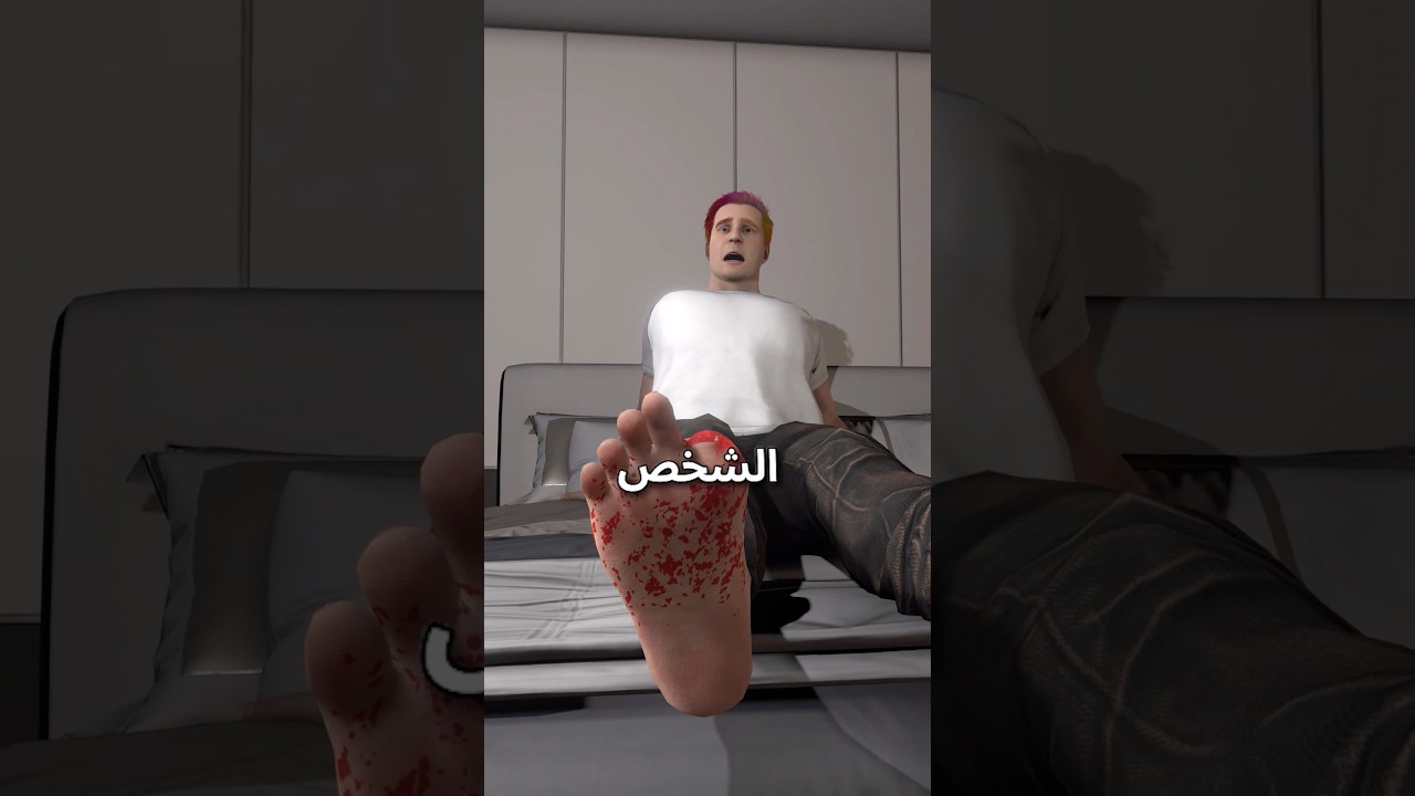 كلب اكل اصبعه صاحبه 🐕