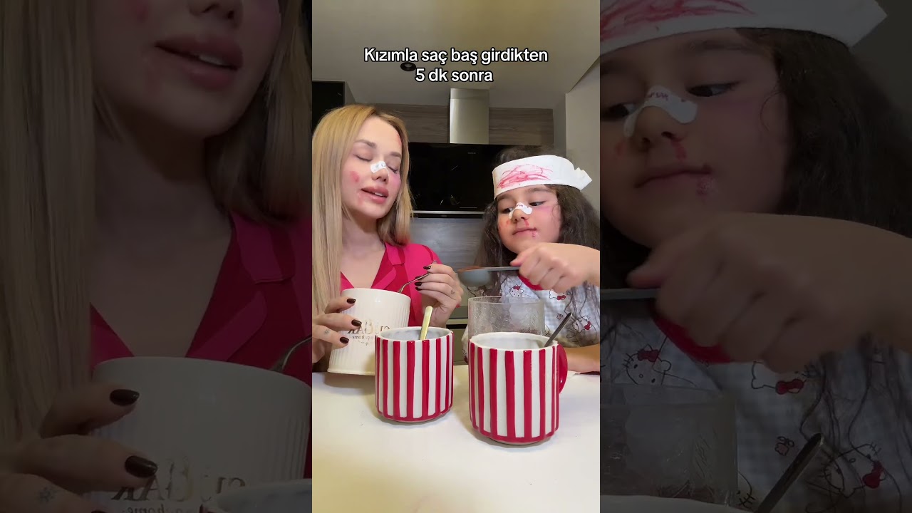 Ufak atışmalar 🤣