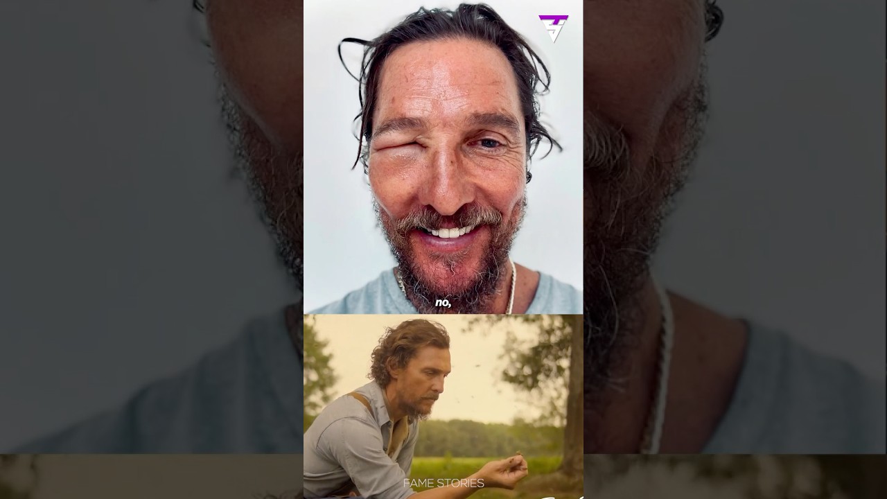 Matthew McConaughey's Eye Swelled Shut from Bee Sting! 😱🐝 #mathewmcconaughey #jimmyfallon