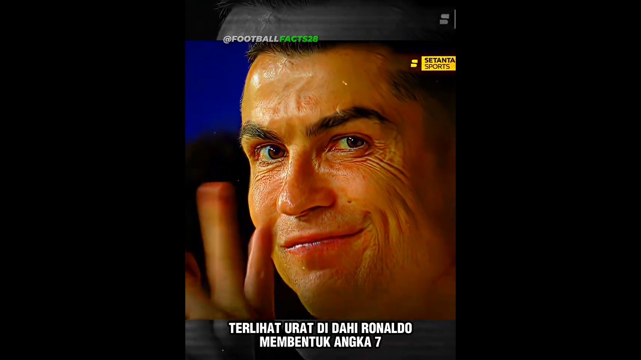 Dahi Ronaldo Uratnya Membentuk Angka 7 ⁉️😱