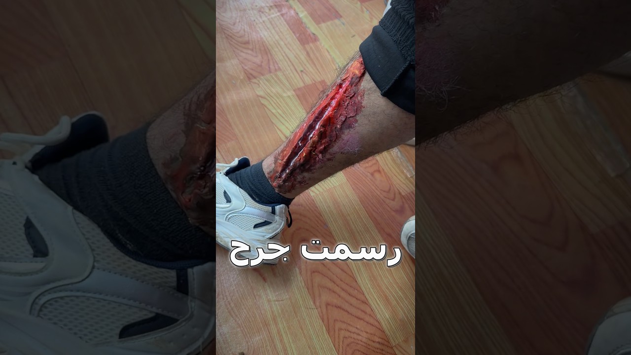 رسمت جرح سنمائي ومقلبت الناس😳#drawing #رسم #shorts