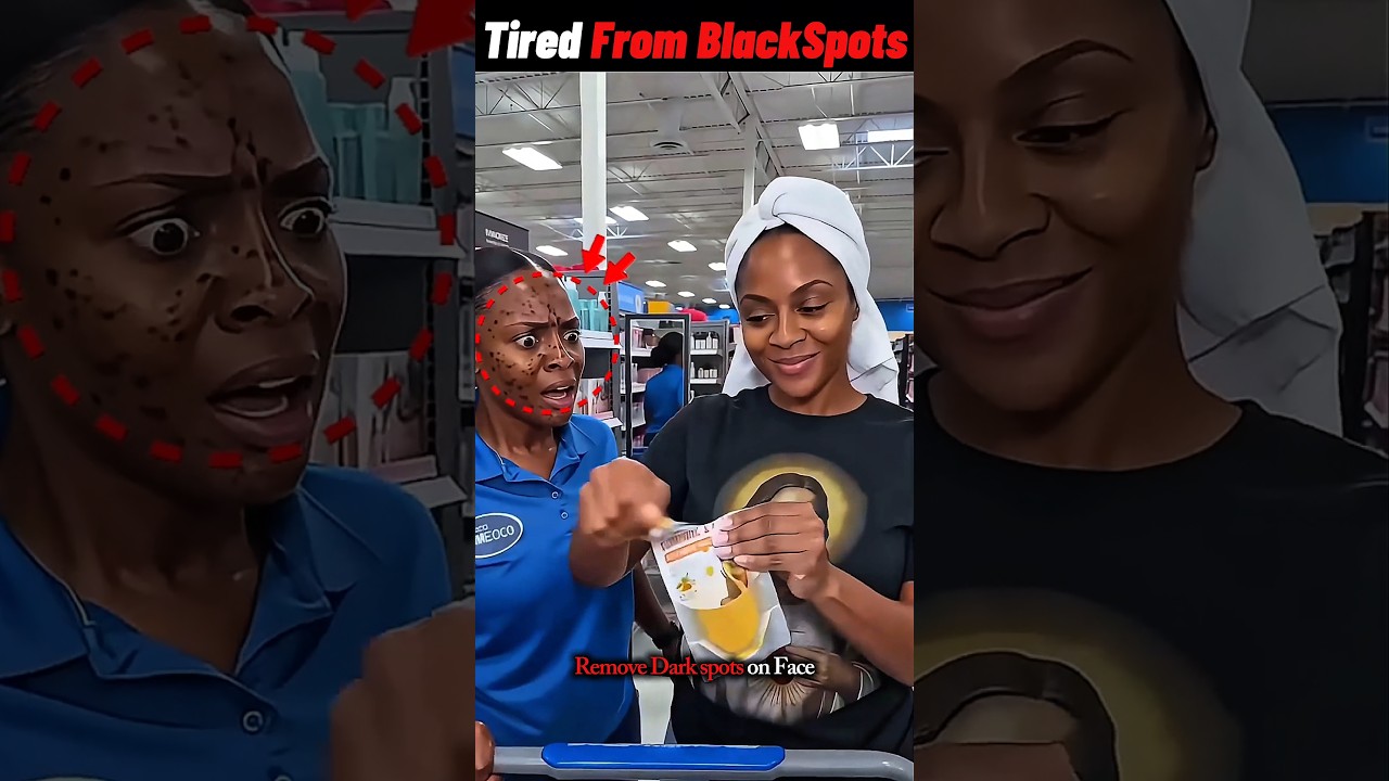 Black Spots Gone Instantly!