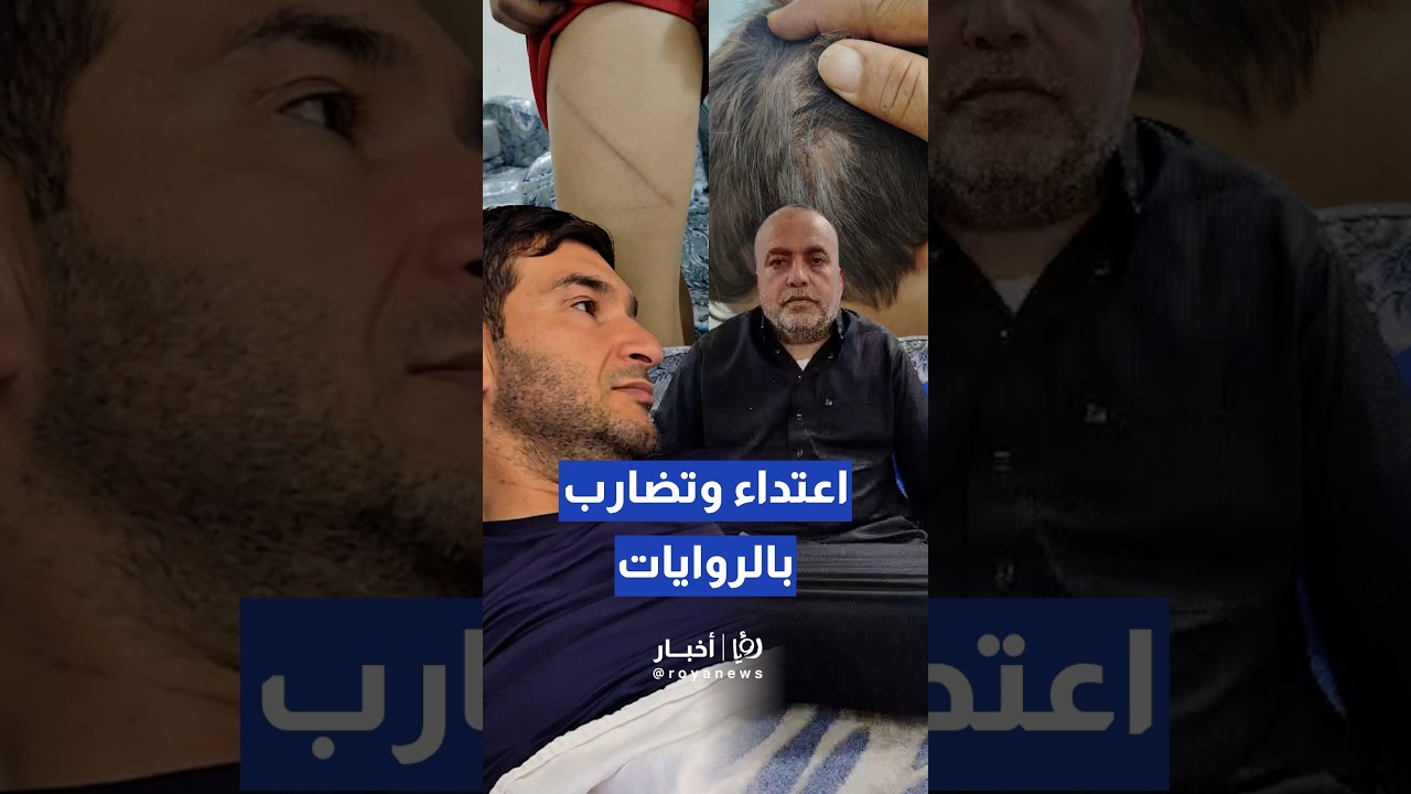 بين رواية المعلم وشهادة عائلة الطفل.. تفاصيل حادثة الاعتداء داخل مدرسة في الطرة في لواء الرمثا