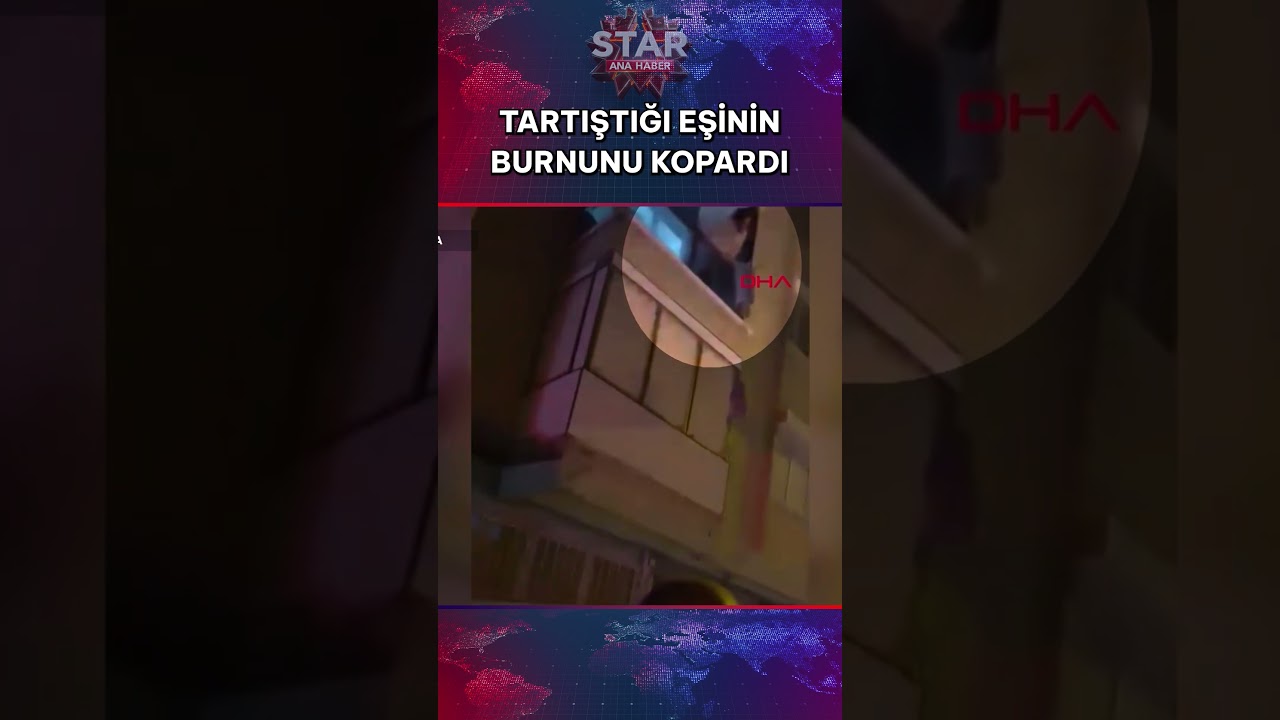 Çocuklarının Gözü Önünde Akılalmaz Vahşet! Eşinin Burnunu Isırıp Kopardı #shorts