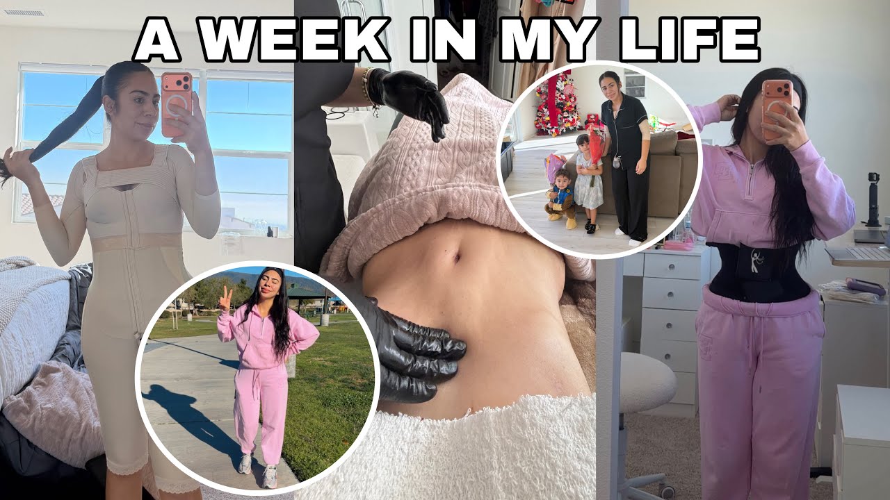 A WEEK IN MY LIFE| Recovering from surgery as a mom of 2  - Published by luluxx