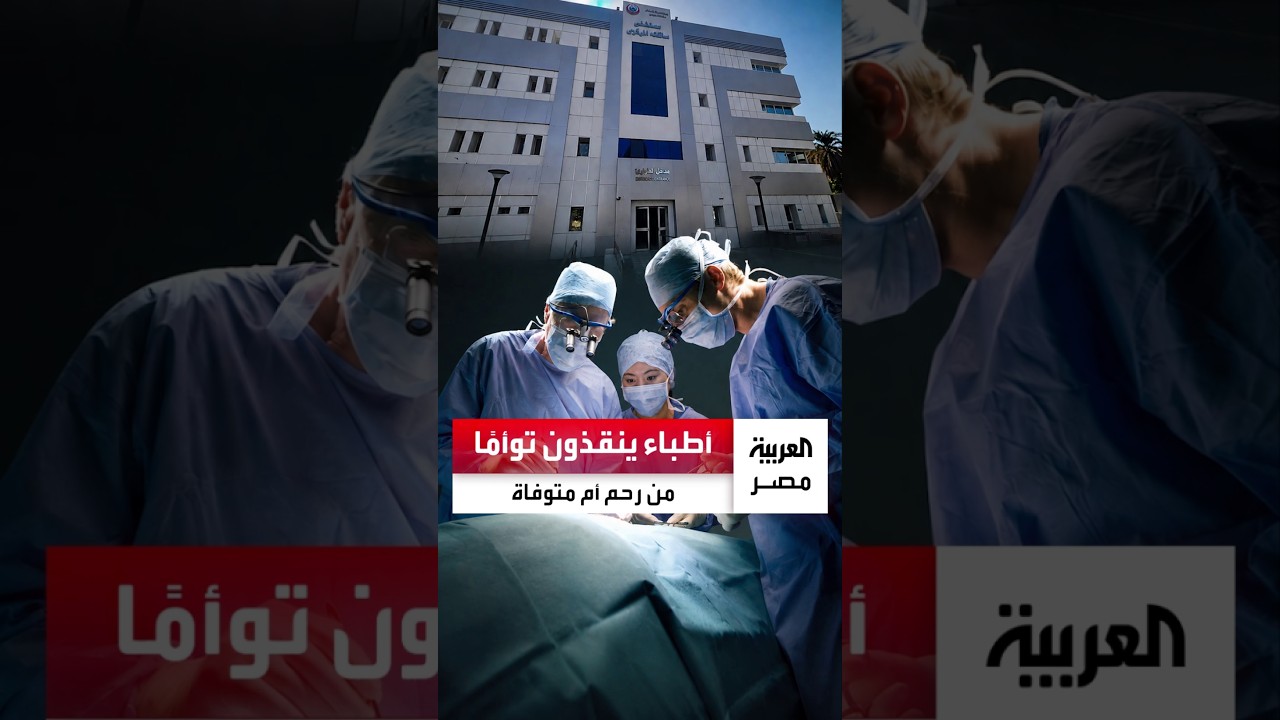 أطباء ينقذون توأمًا من رحم أم متوفاة في جراحة نادرة بسوهاج