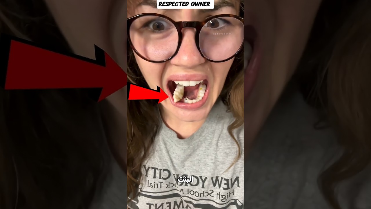 سنانها اتكسرت وهيا بتغسل بفرشة الاسنان😰👀☠️