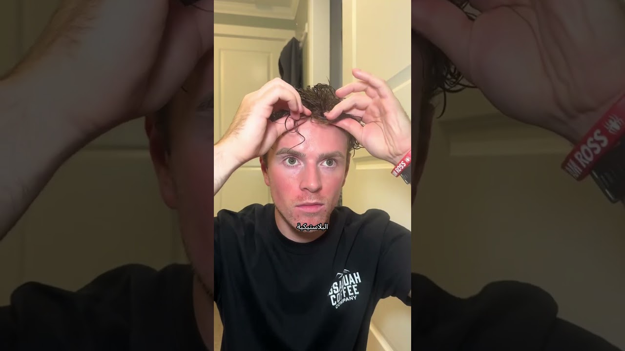 كانوا يطقطقون عليه… شوف كيف تغيّر بشكل صادم