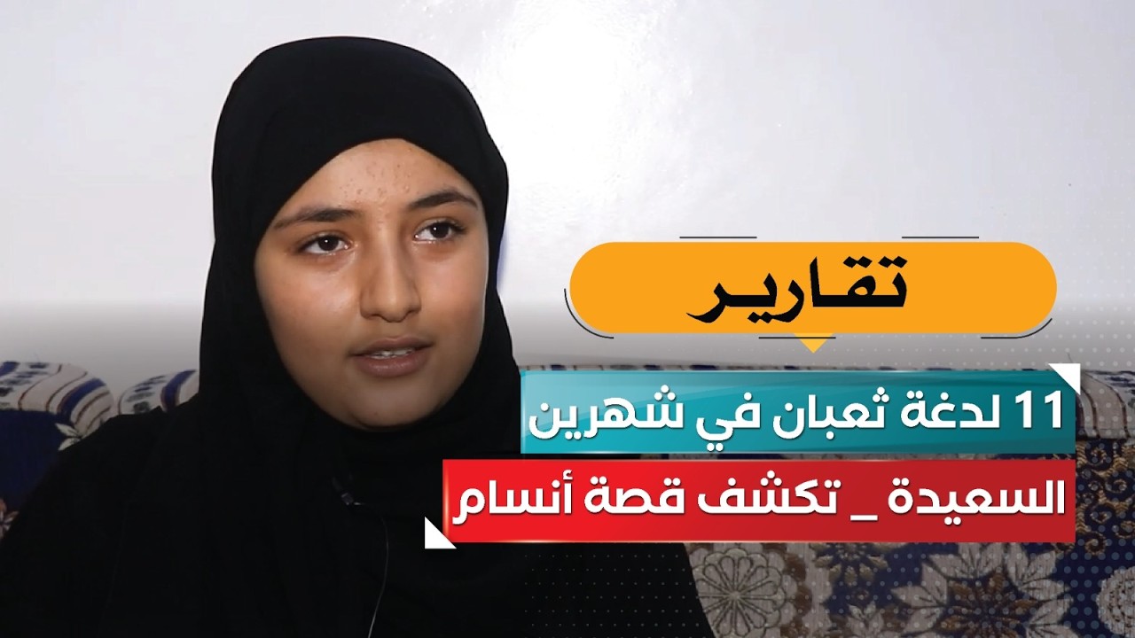 11 لدغة ثعبان في شهرين!.. «السعيدة» تكشف قصة أنسام
