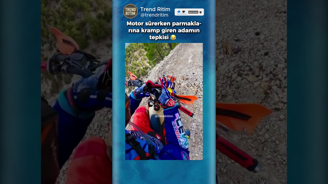 Motor Sürerken Parmaklarına Kramp Giren Adam 😂😁