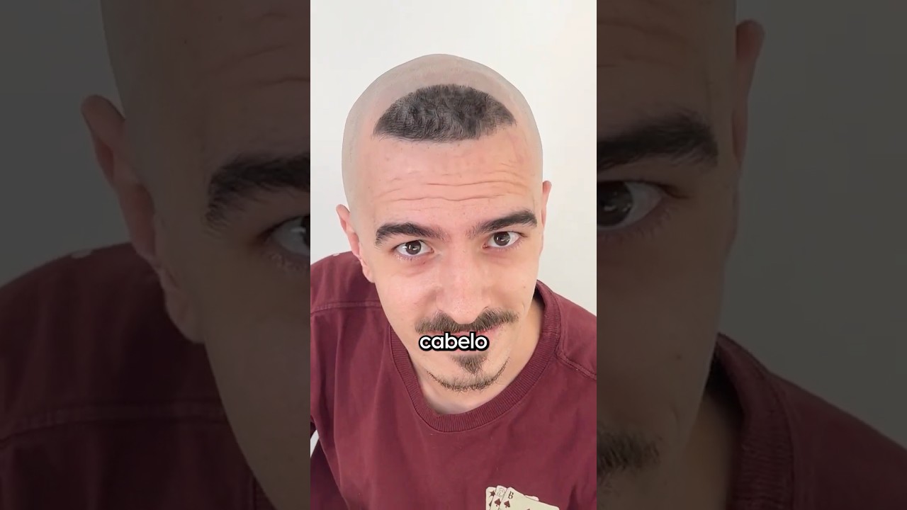 por que o Ronaldo usava aquele cabelo?