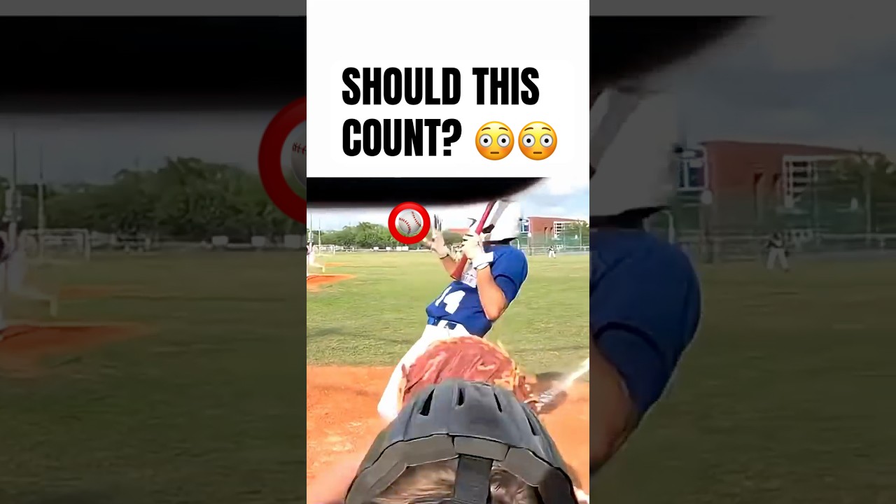 hit by pitch? 😳