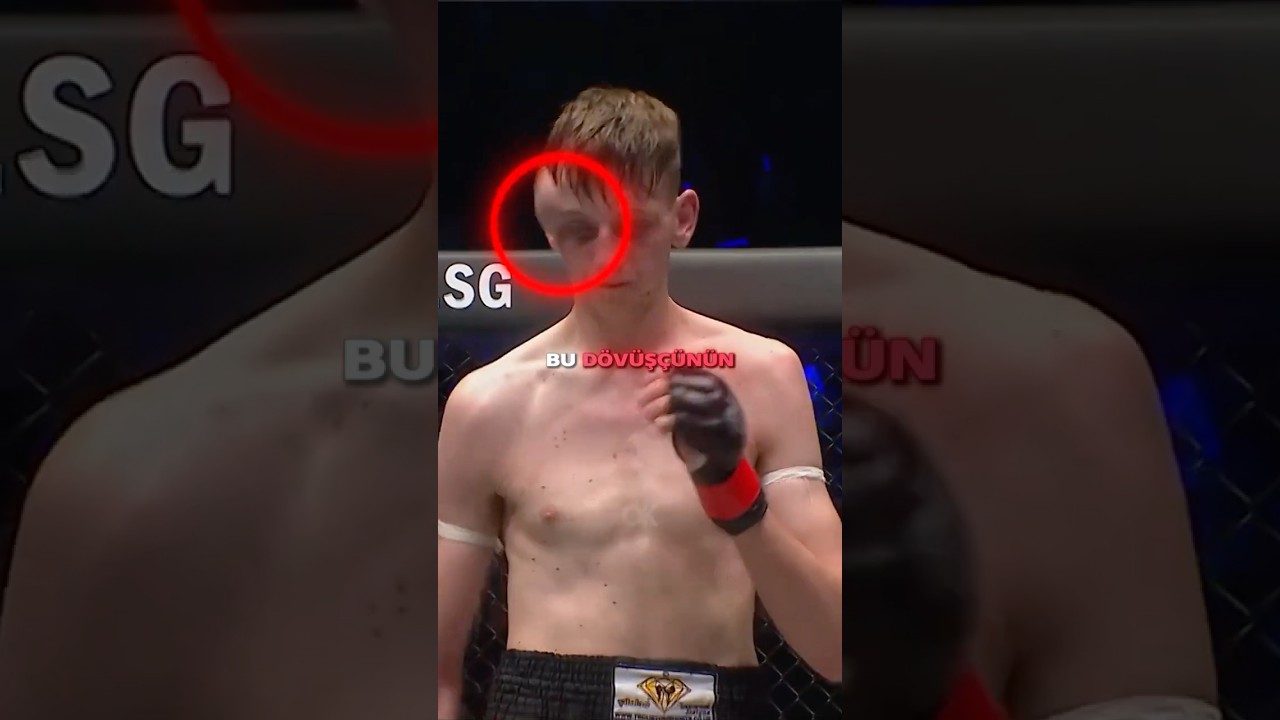 Suratı Balon Gibi Şişmeye Devam Ediyordu😱