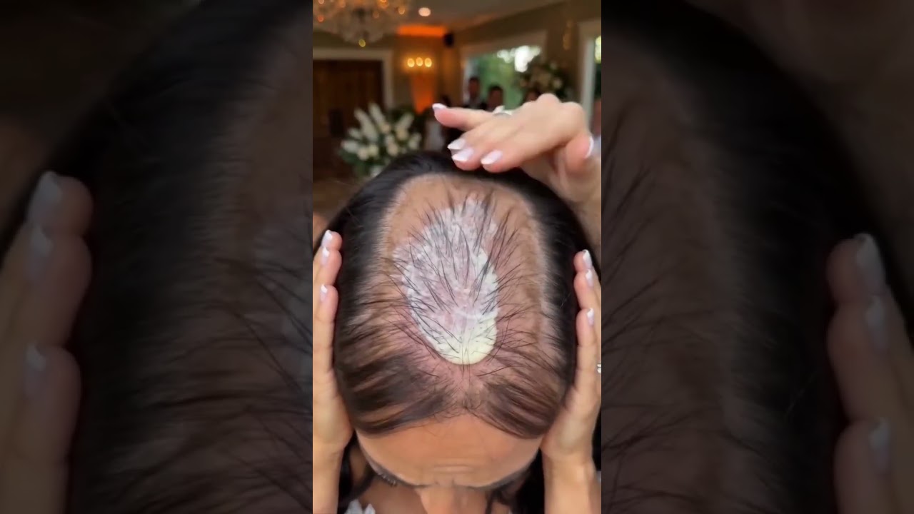 عروس خدعت العريس حاطة باروكة عالشعرها